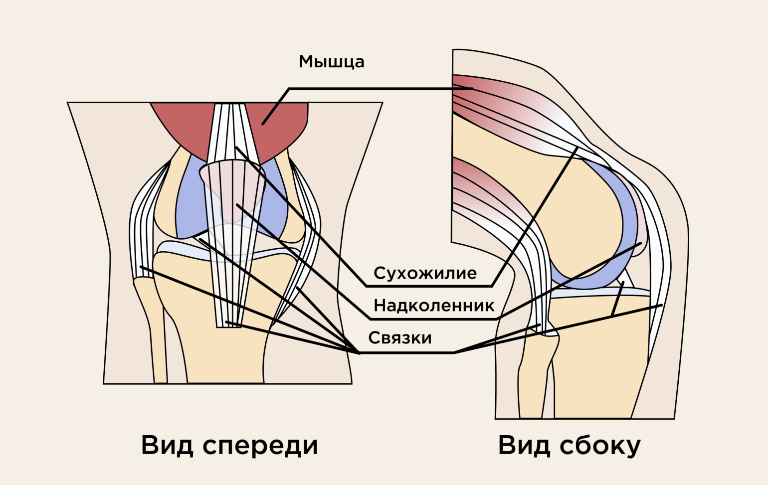 Растяжение мышц: симптомы и лечение
